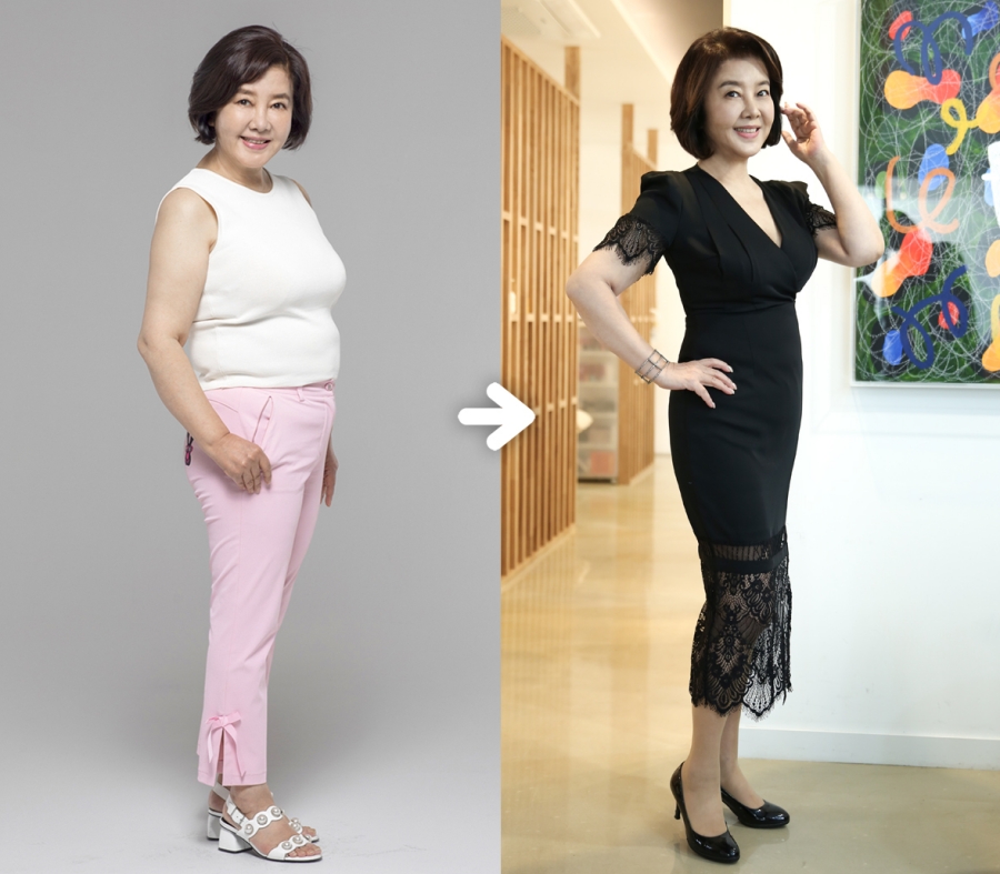 김영란, 10kg 감량 후 되찾은 전성기 미모…
