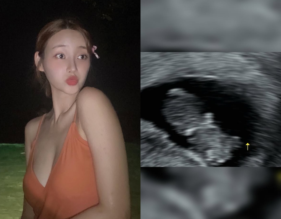 '작곡가♥' 유나, 임신 발표 