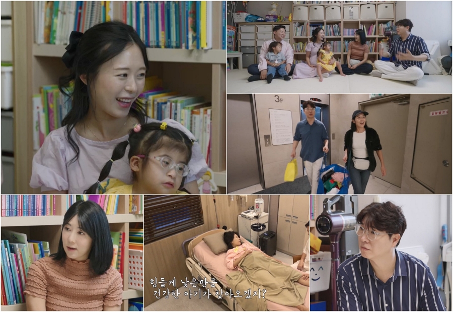 0.01% 확률로 태어난 희귀 기형 아기…母 