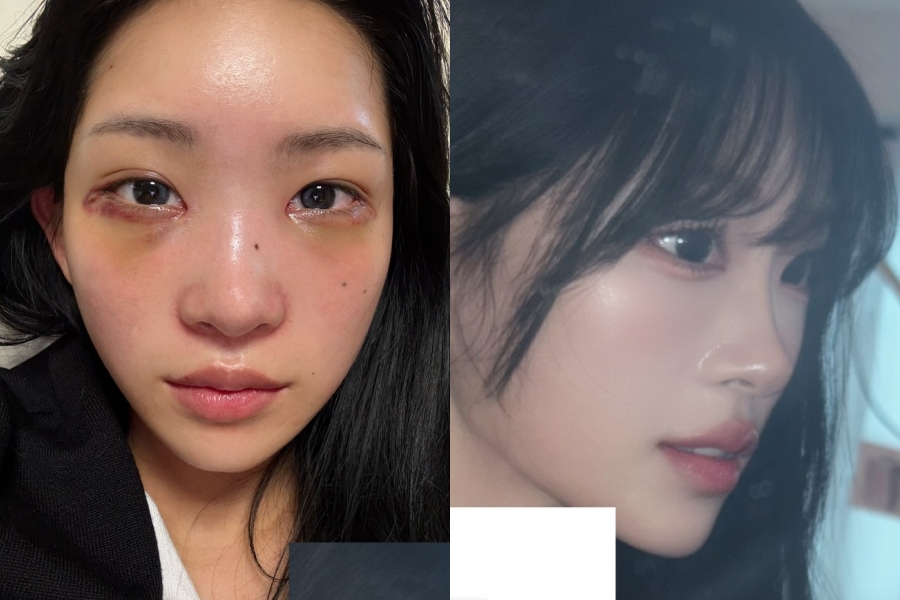 ����: ������ �ν�Ÿ�׷�