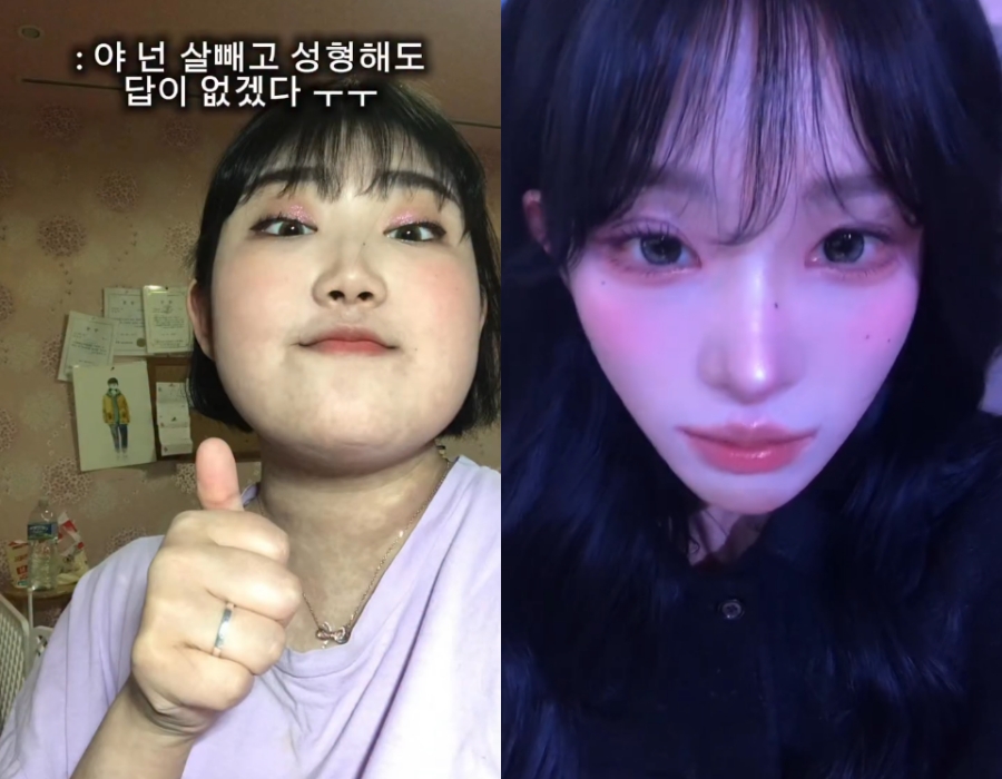 '故 최진실 딸' 최준희, 다이어트+성형 전후 비주얼 공개 