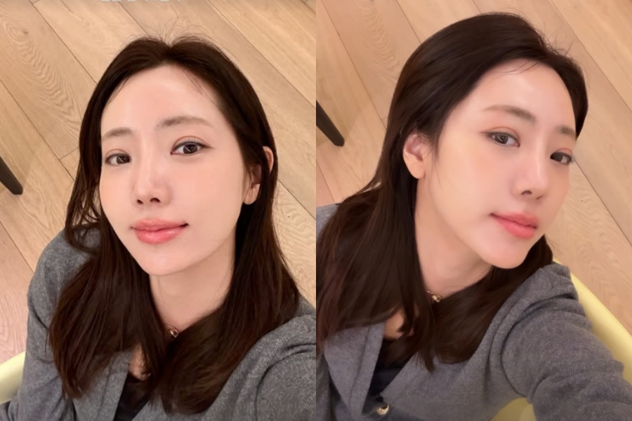 '아들맘' 정순주, 입술 필러 후 더 섹시해진 분위기…