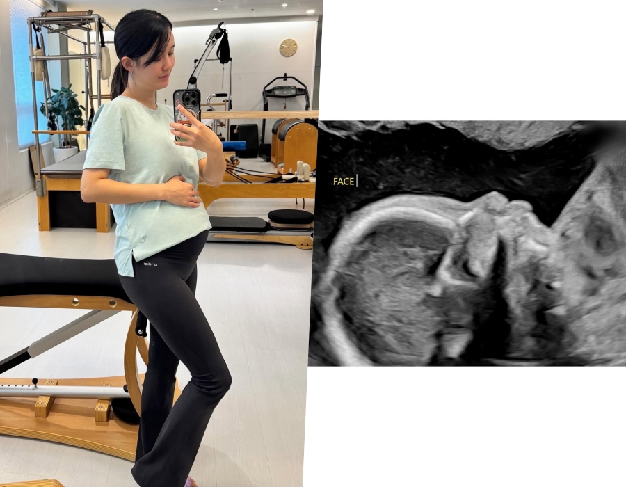 ���� : ������ �ν�Ÿ�׷�