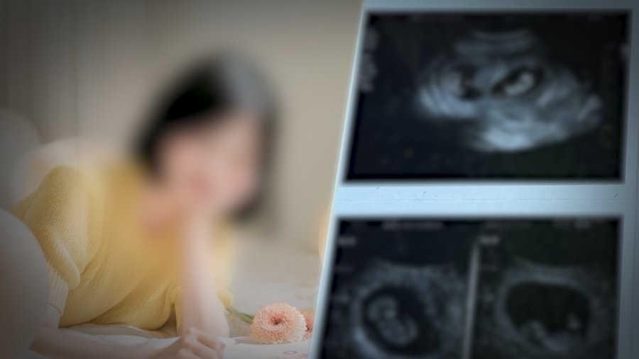 ����: SBS ����