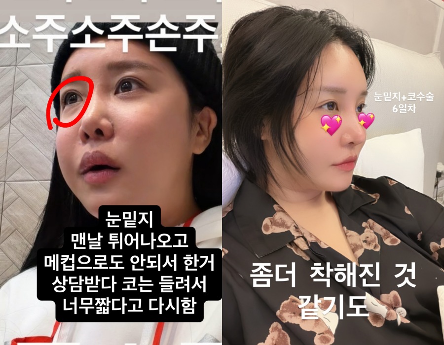 사진 : 랄랄 인스타그램