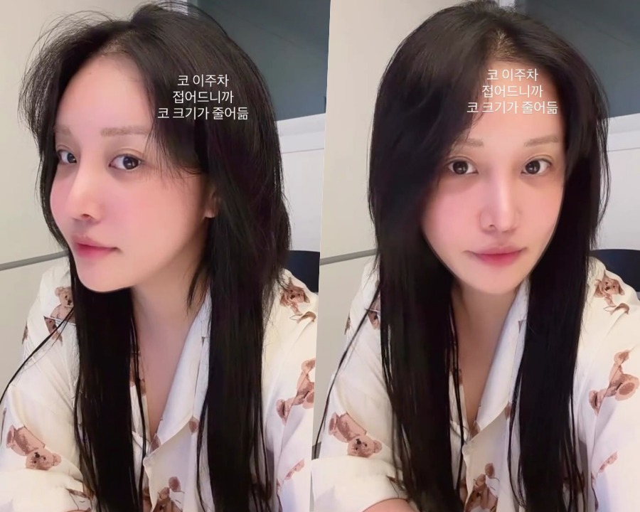 이명화 어디로…랄랄, 성형+2주 만에 3.2kg 감량 후 청순 비주얼에 '깜짝'