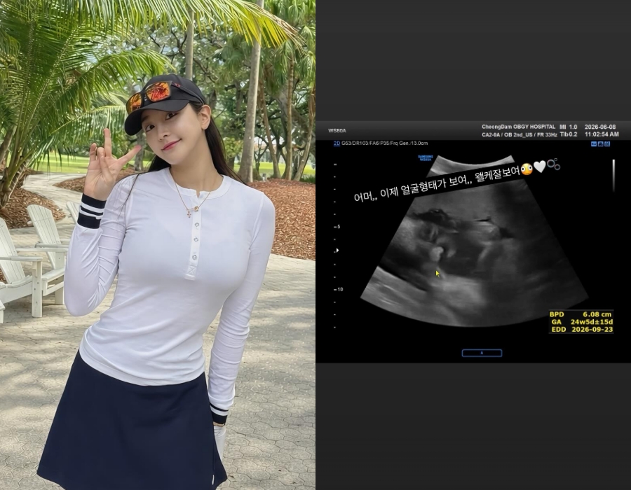 '혼전임신' 알린 걸그룹 출신 배우, 초음파 사진에 깜짝 