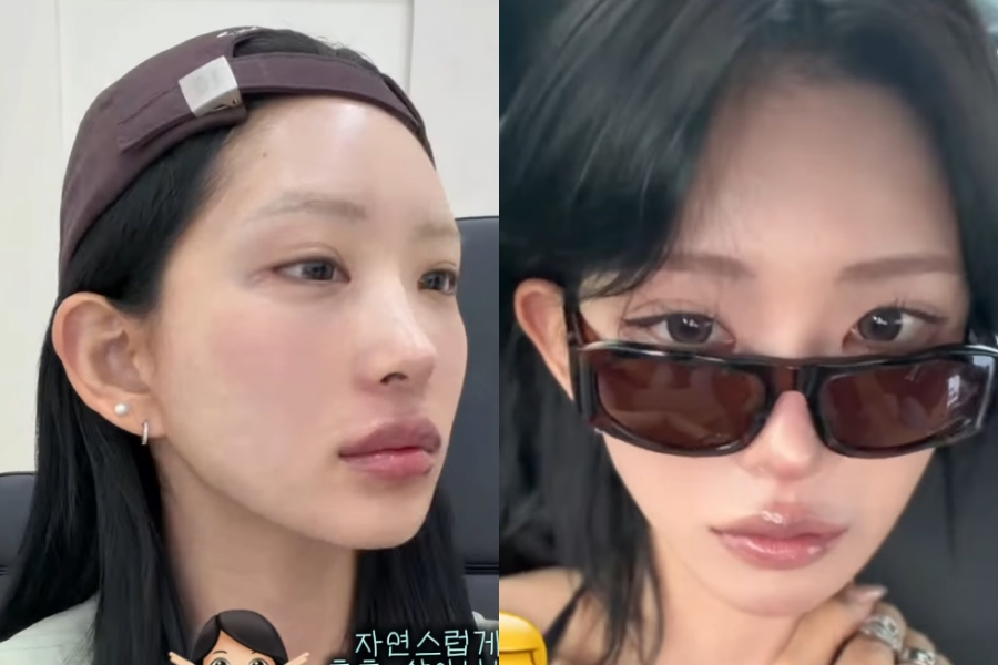 '故 최진실 딸' 최준희, 골반괴사 와중에도 미용 시술ing…